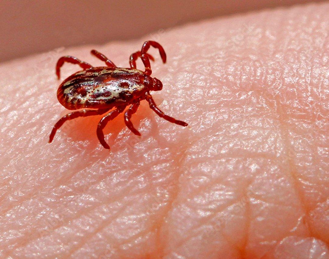 Mogi Guaçu registra primeiro óbito por Febre Maculosa de 2023